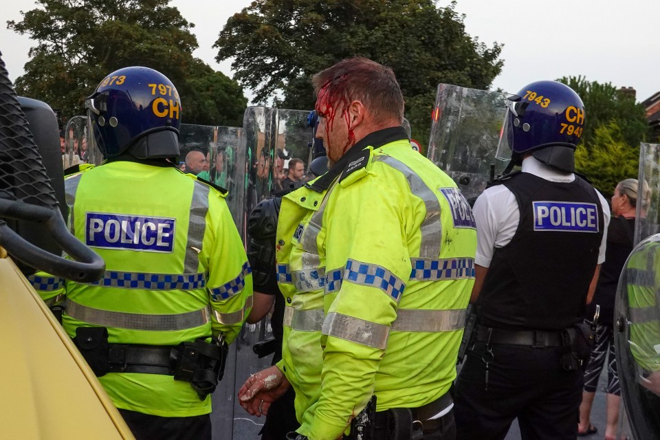 A police officer was left bloodied after a night of violence