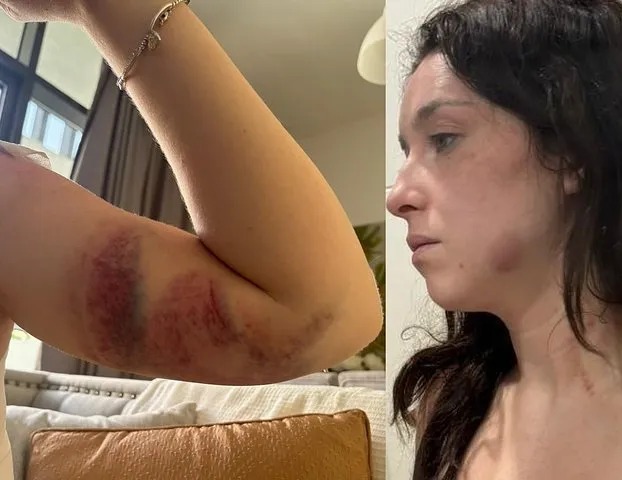 Tori said one Dubai cop taunted her despite visible signs of severe bruising and other terrible injuries