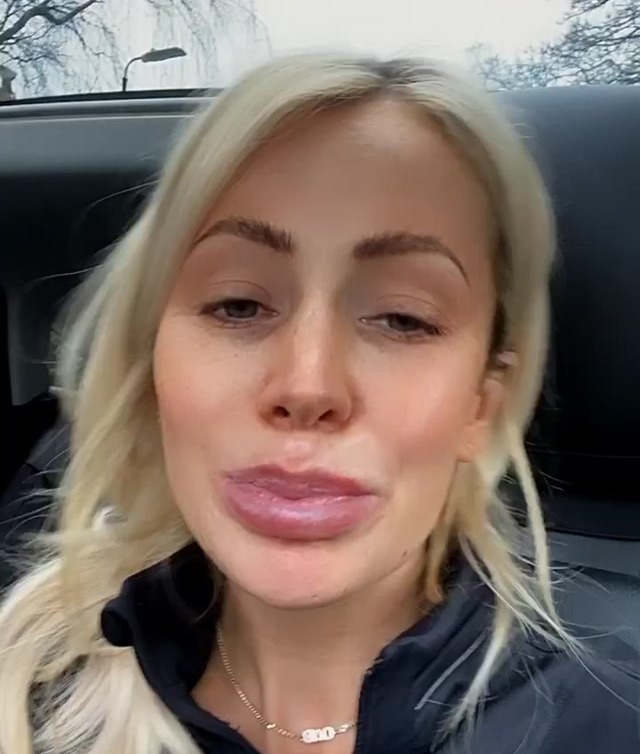 Olivia, pictured here in 2019, admits she went "too far" with lip filler