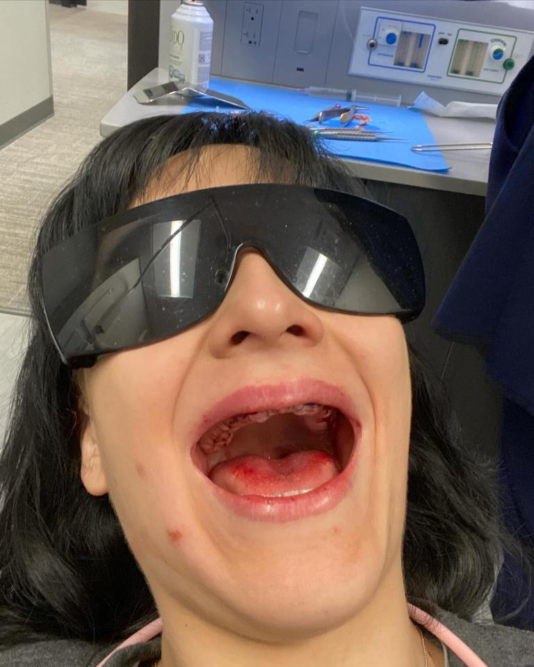 The 29-year-old at the dentist during the long procedure to get her teeth fixed