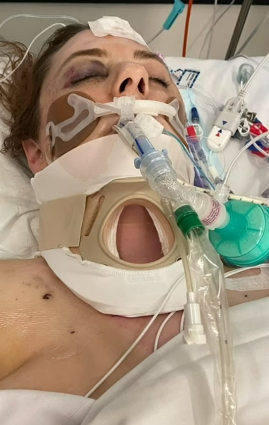 Another picture released by her family shows Shylah fighting for her life at the hospital just days after the horror crash