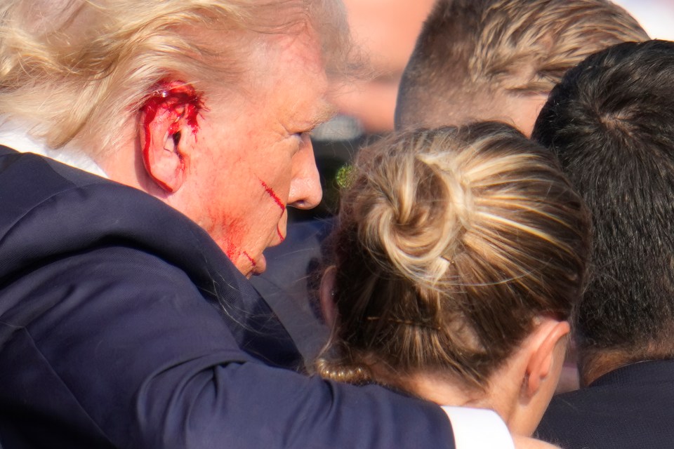 Blood is smeared across Trump's ear after the shooting