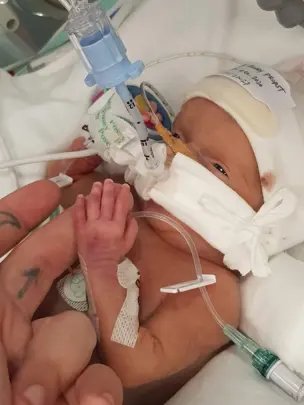 Sunny Parker-Propst Baby who died through neglect in hospital Family Handout