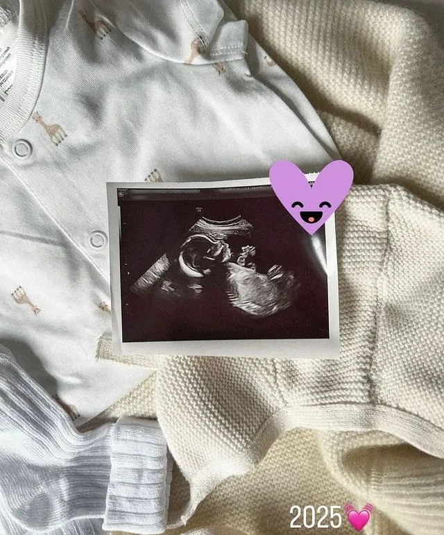 Milla Corfixen was cruelly trolled after a fake account pretending to be her posted this baby scan