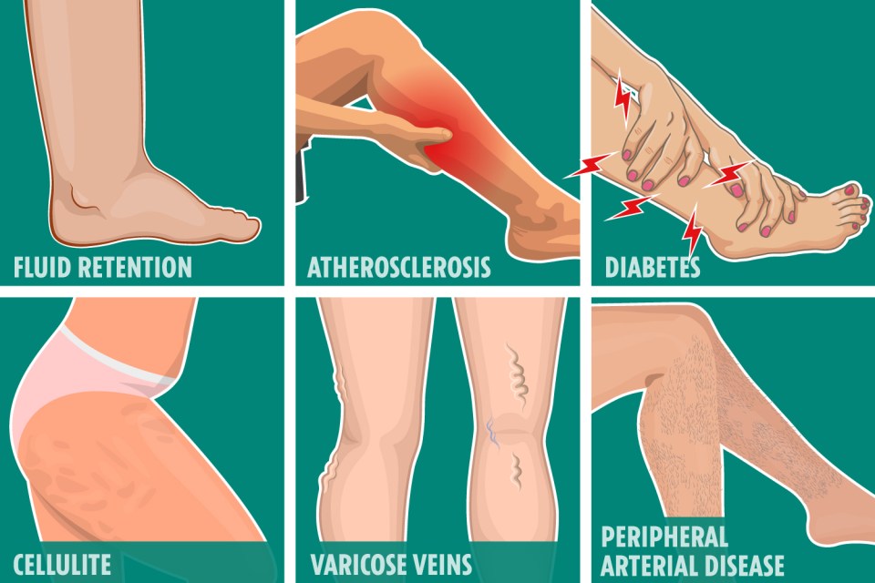 From visible veins to hair loss on your legs - your pins have a lot to say about your health