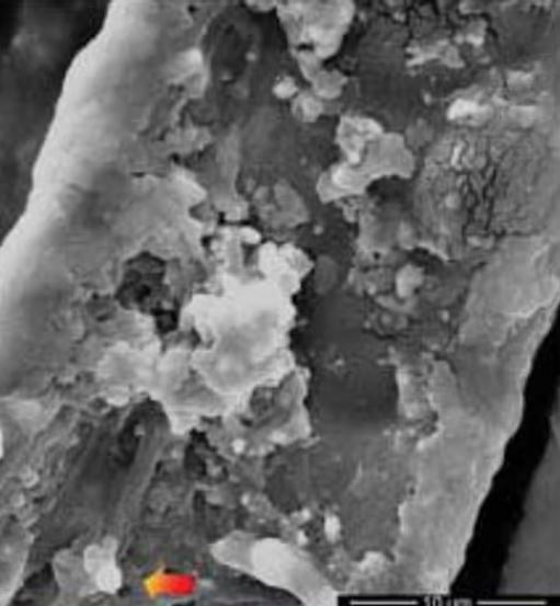 The study analyzed samples taken from the 1970s. Researchers collected particles using adhesive tape. Pictured are the samples zoomed in 1,500 times