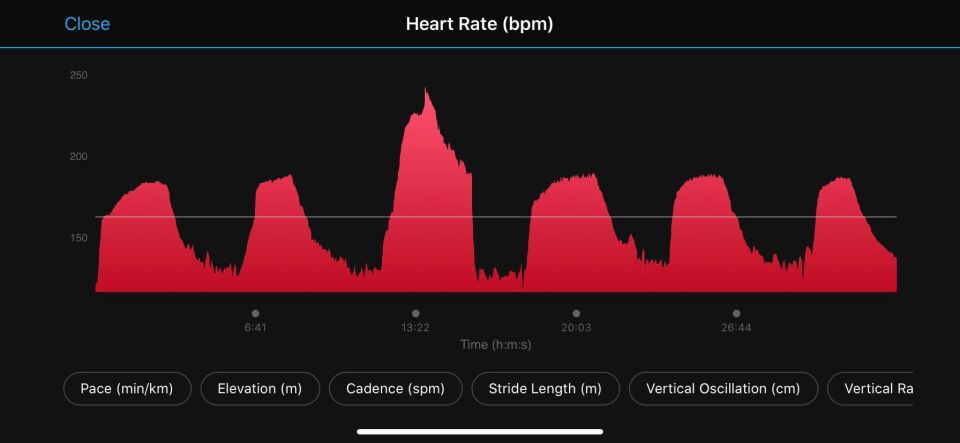 His heart rate problems began when he was just 10 years old