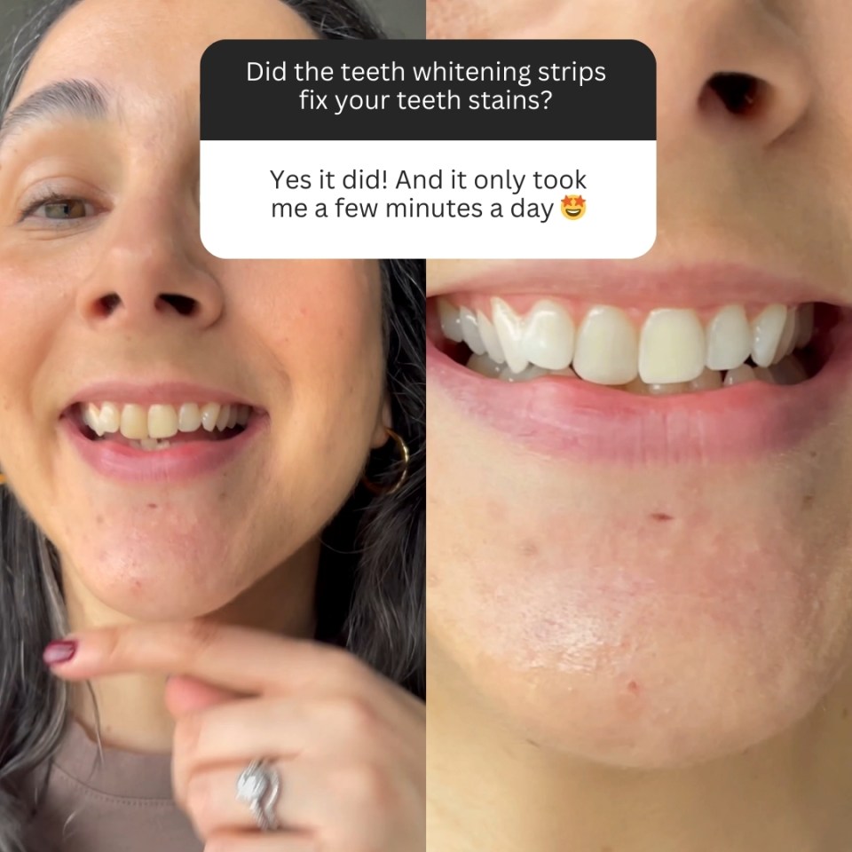 a woman has a question about teeth whitening strips