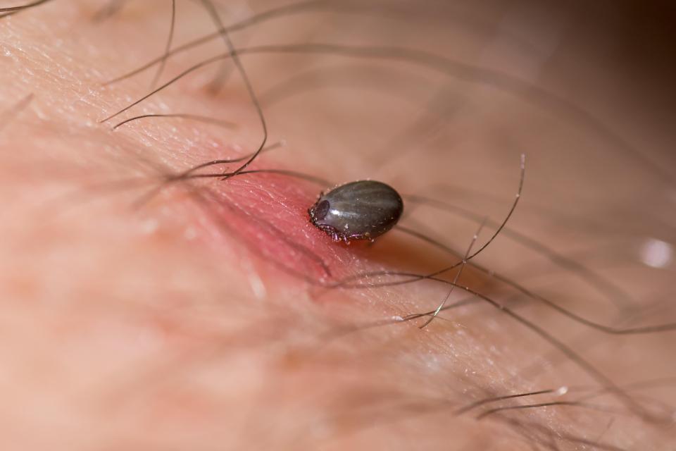 Ticks bury into the skin