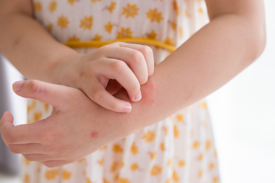 a girl in a yellow and white dress is scratching her arm