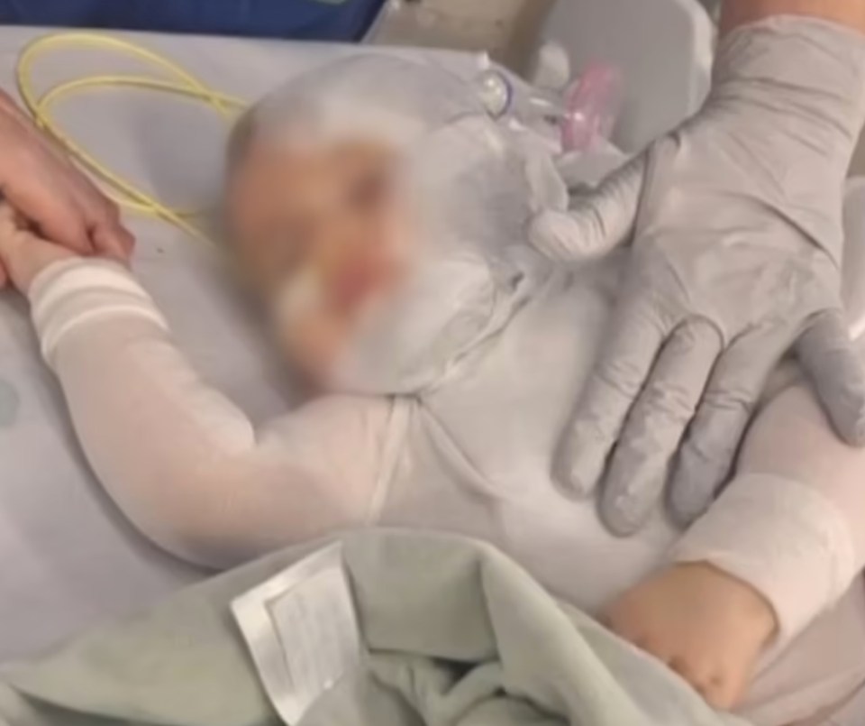 A baby has been left with 60 per cent burns after stranger doused him with scalding hot coffee