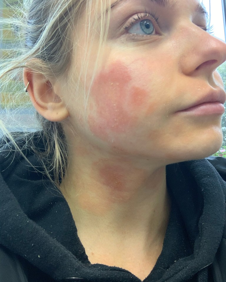 a close up of a woman 's face with red spots