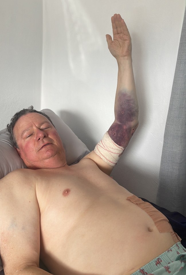 Roland needed seven operations in a fortnight following the bruising attack