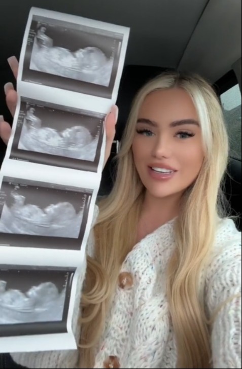 a woman in a white sweater is holding a stack of ultrasound images