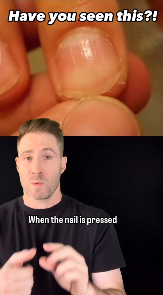 a man is talking about when the nail is pressed