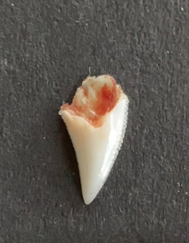 The tooth of the shark, taken out of Angus' arm