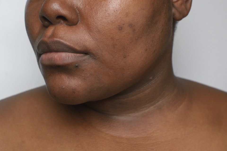 a close up of a woman 's face and neck