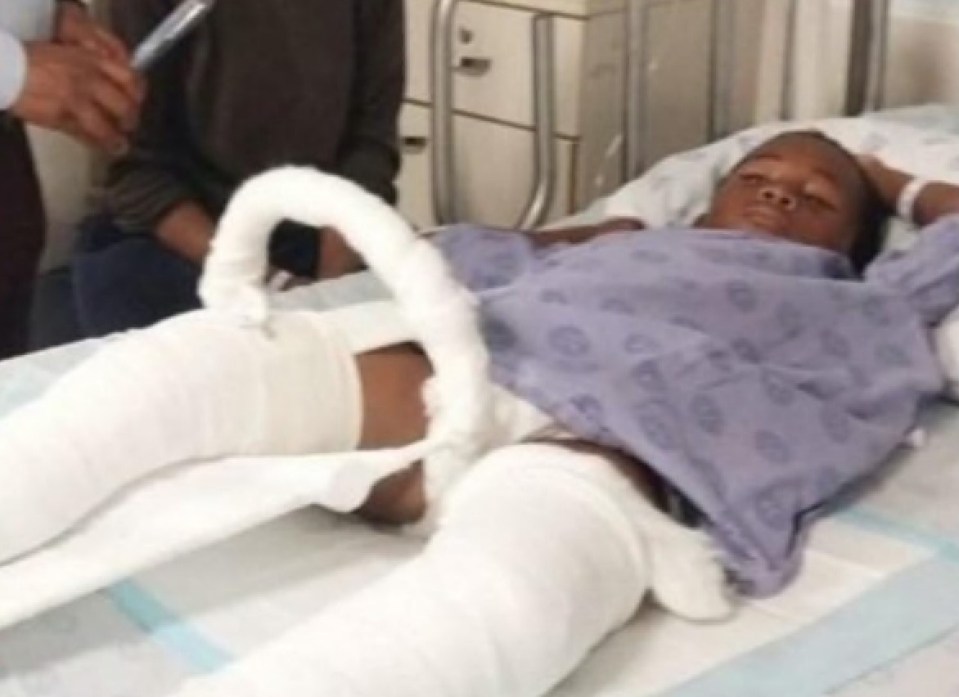 Khwezi Jantijies, broke both of his legs in the horrific incident