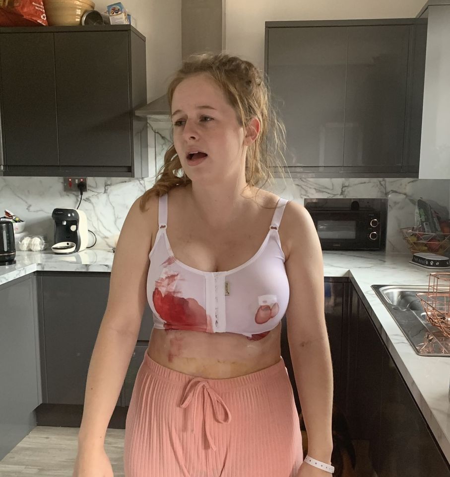 Paige Harvey in a bloodied bra after having a boob reduction