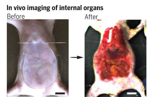 in vivo imaging of internal organs before and after