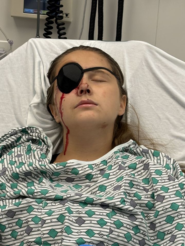 The 18-year-old arrived at the hospital covered in blood with a bruised right eye