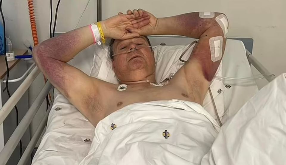 British tourist Roland Cherry, 63, was viciously mauled by a hippo