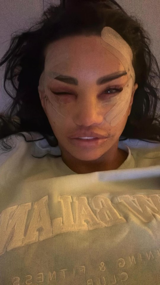 Katie Price has alarmed fans with recent photos