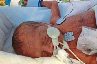 Oscar Barker was born early at Addenbrooke's Hospital in Cambridge and passed away aged one month