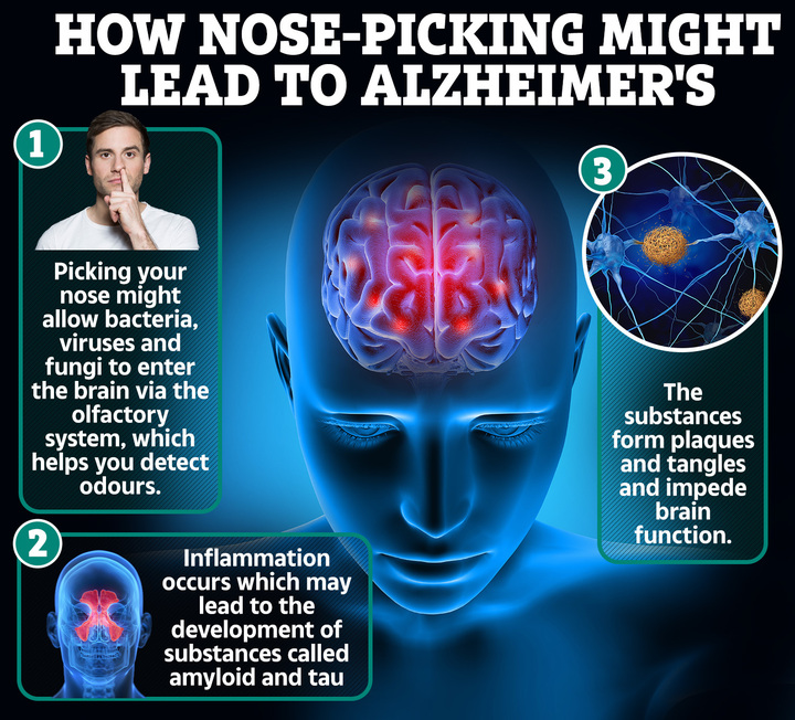 How scientists theorise nose picking can lead to Alzheimer's