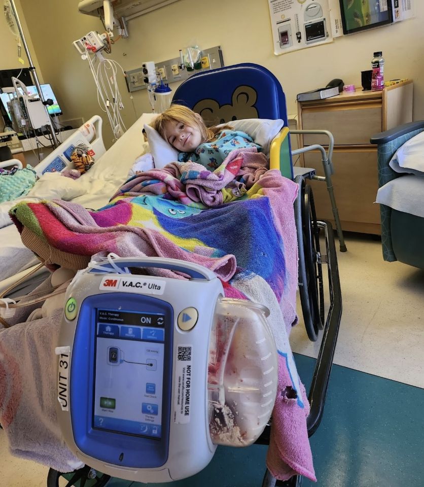 a child in a hospital bed with a 3m v.a.c. ultra device