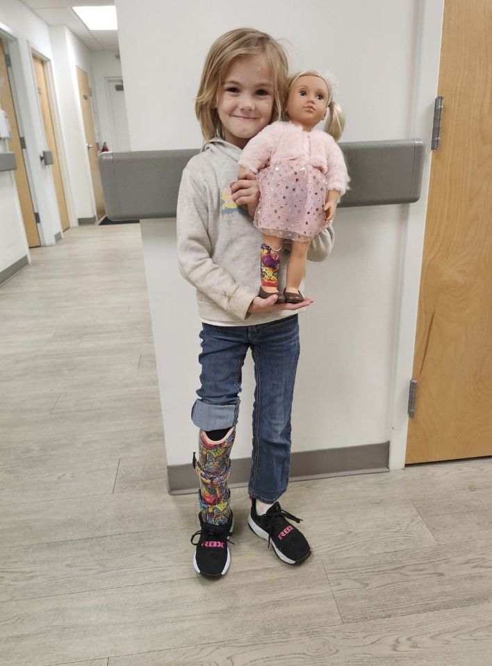 a little girl with a prosthetic leg holds a doll