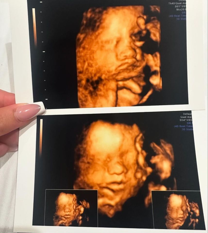 Georgia shared four ultrasound scans of their upcoming arrival along