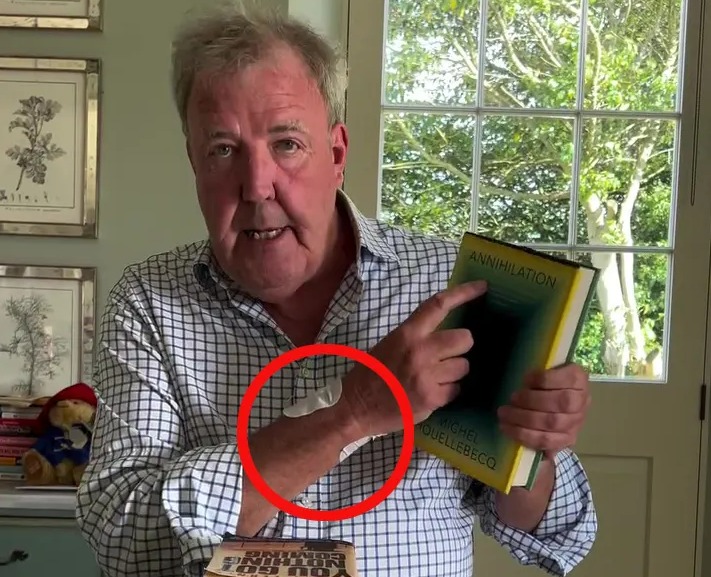 The Clarkson's Farm star was spotted with a bandage on his wrist on social media