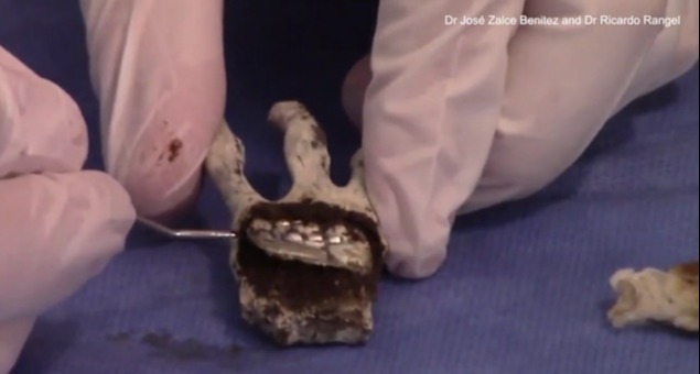 A scientist claimed he discovered metal under the flesh of an 'alien mummy' hand