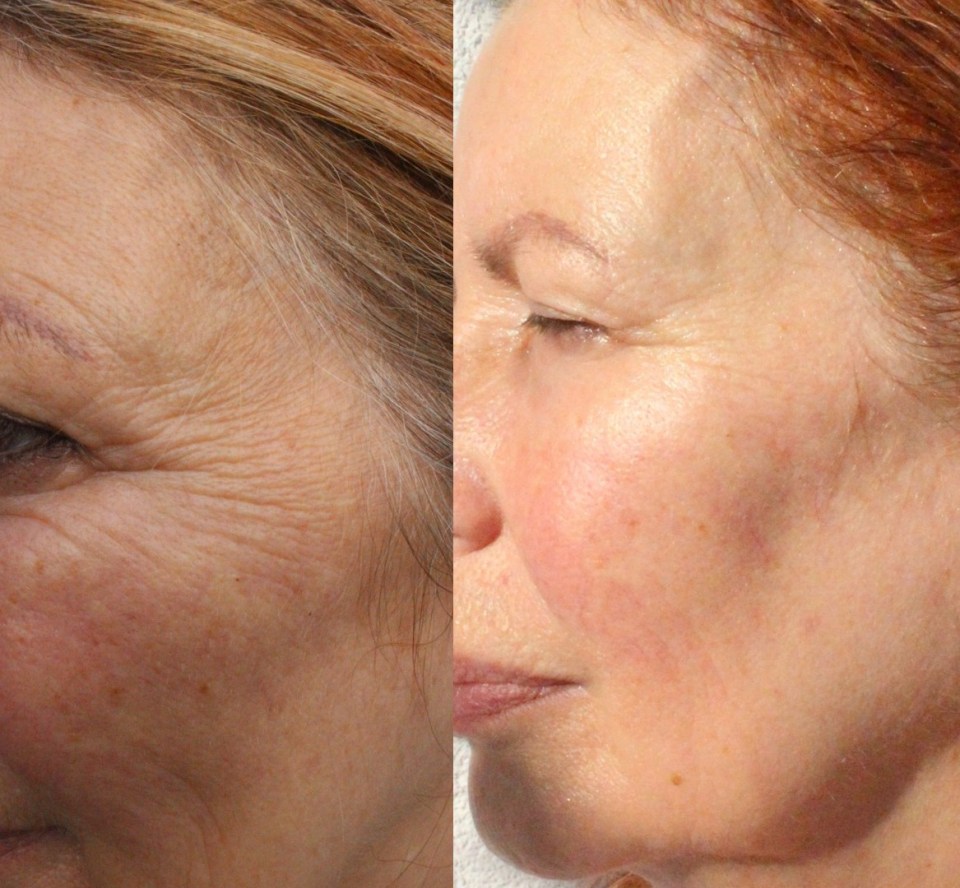 a before and after photo of a woman 's face