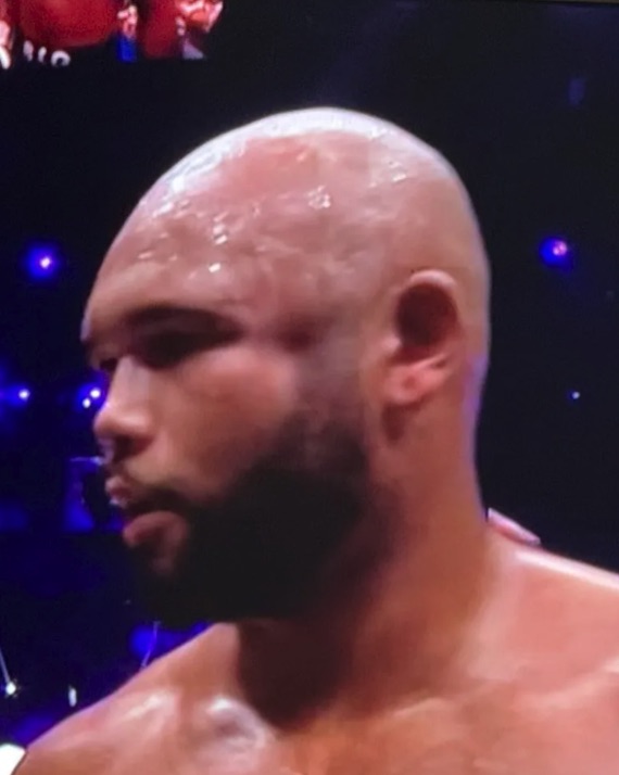 a close up of a boxer 's face with a blurry background