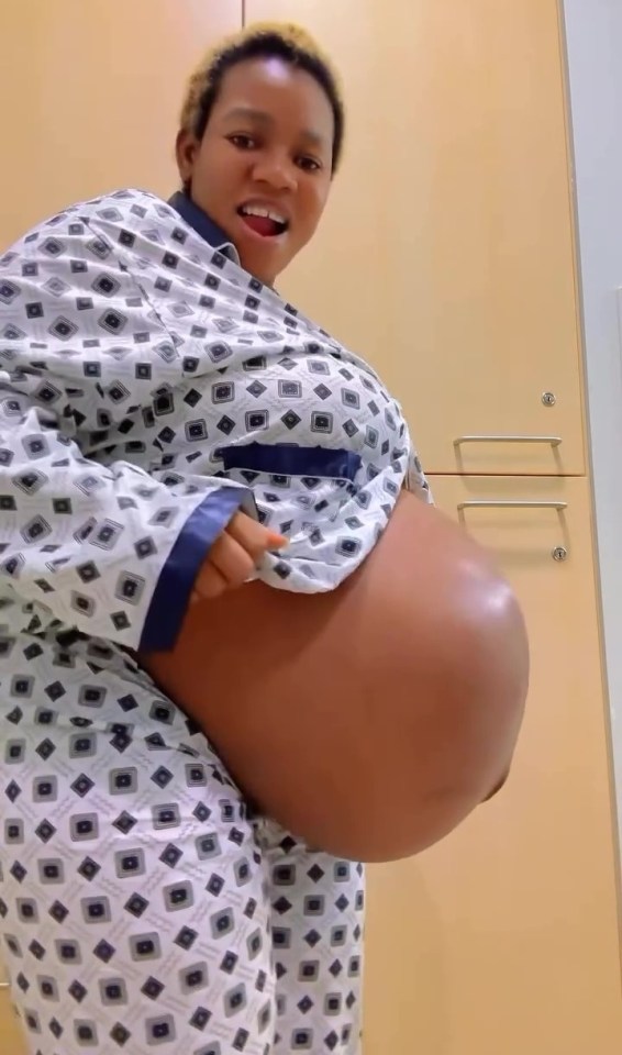 She was carrying triplets, and has since safely given birth to three beautiful boys