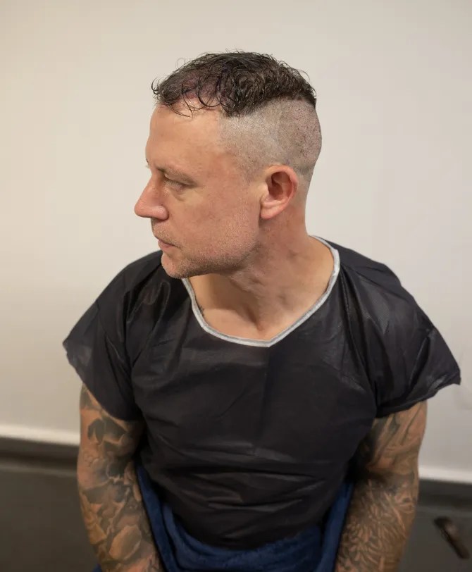 Bridge showed off his new look after undergoing the procedure