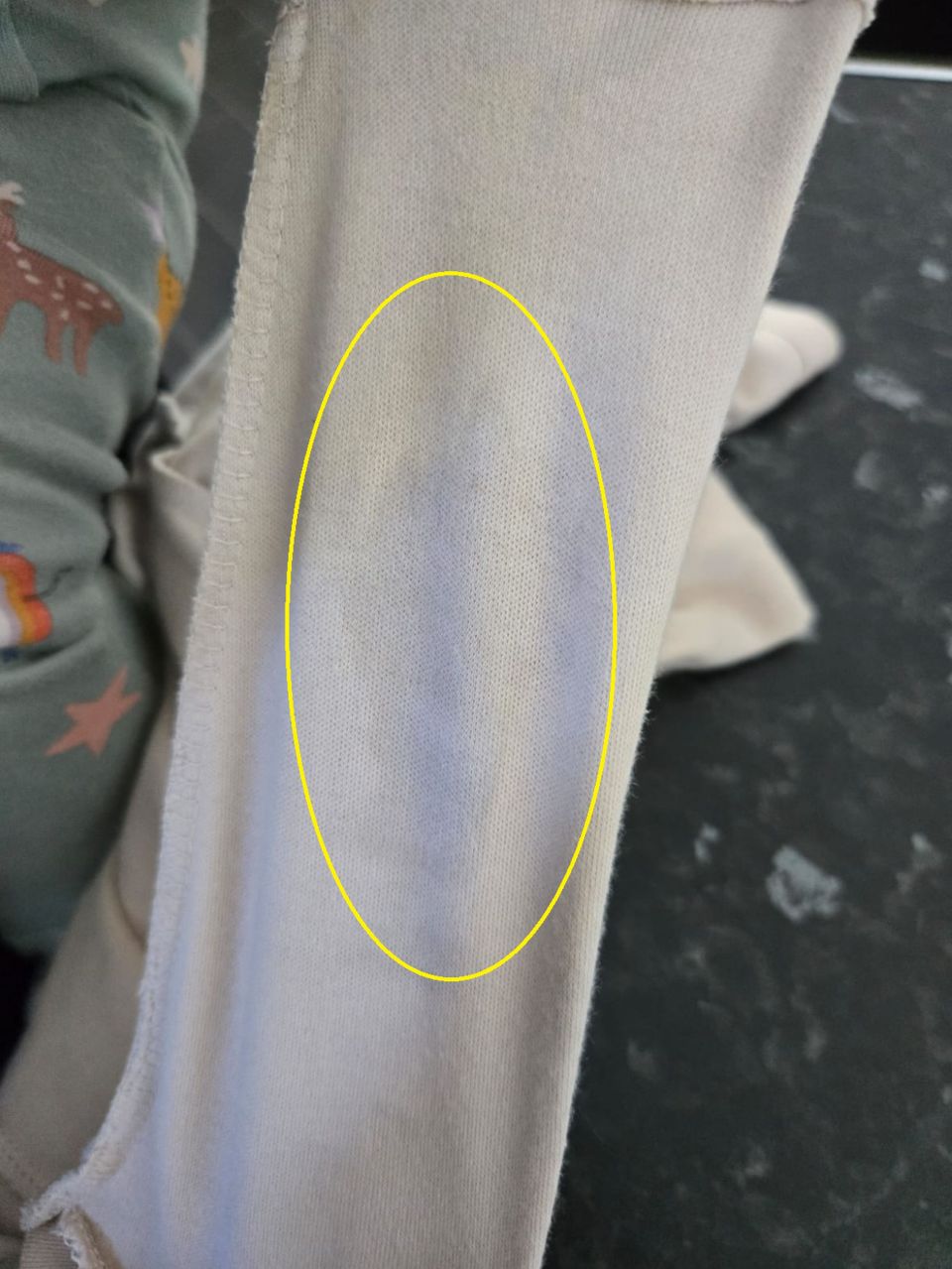 The greasy stain on Amias's babygrow