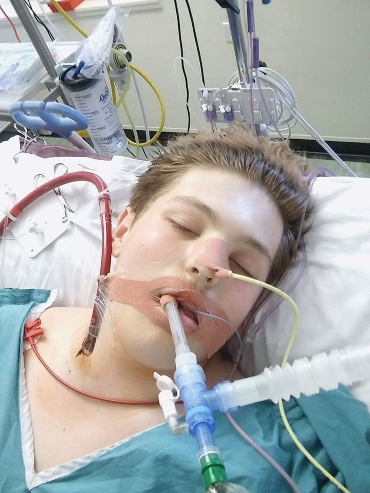 Ewan Fisher, 18, who switched from cigarettes to vaping was left with the lungs of an 80-year-old after the organs failed