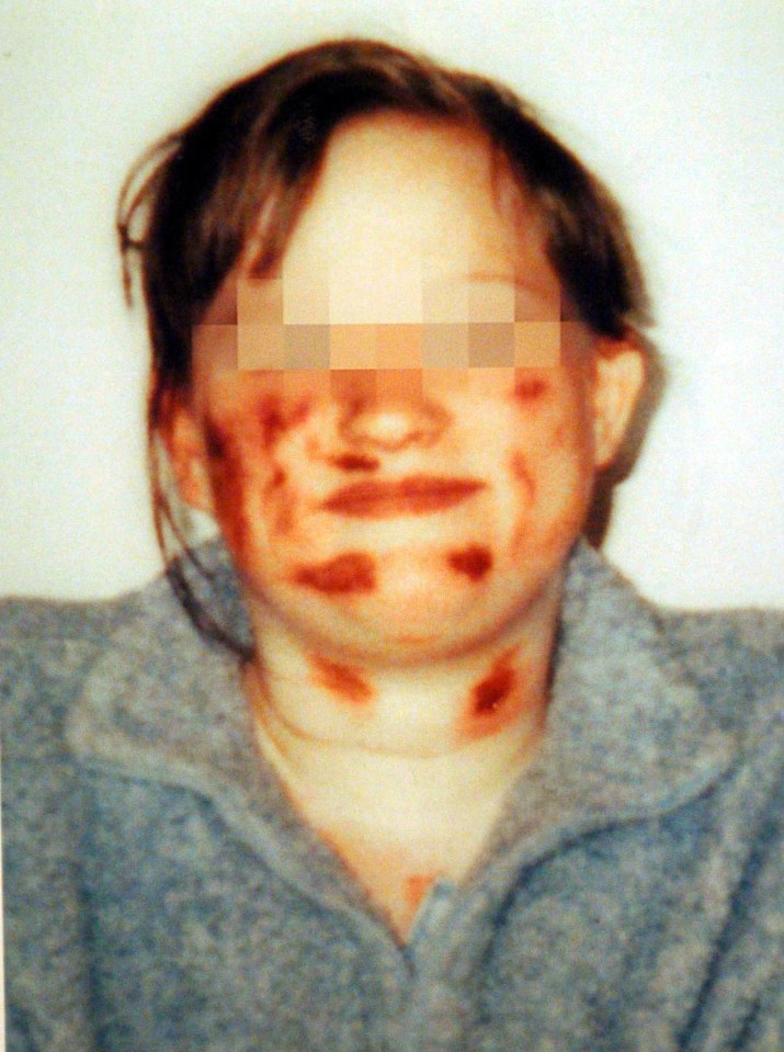 The horrific injuries of one of the girls – known as Victim A in the trial