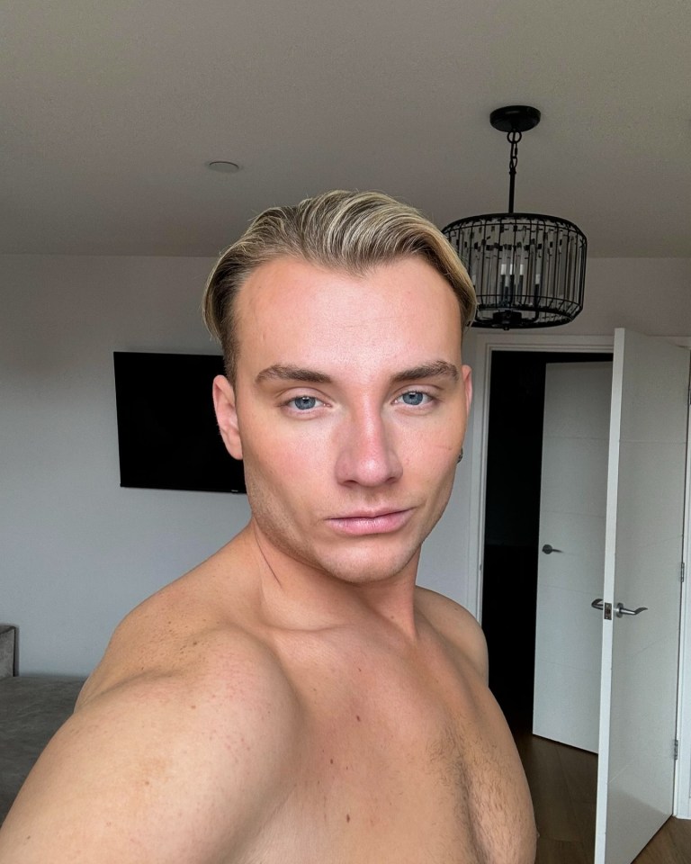 Harry Derbidge shared a series of steamy snaps as he said he was "doing much better"