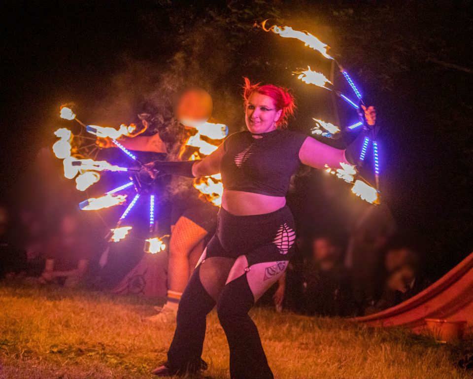 She burnt her face and body while fire-dancing