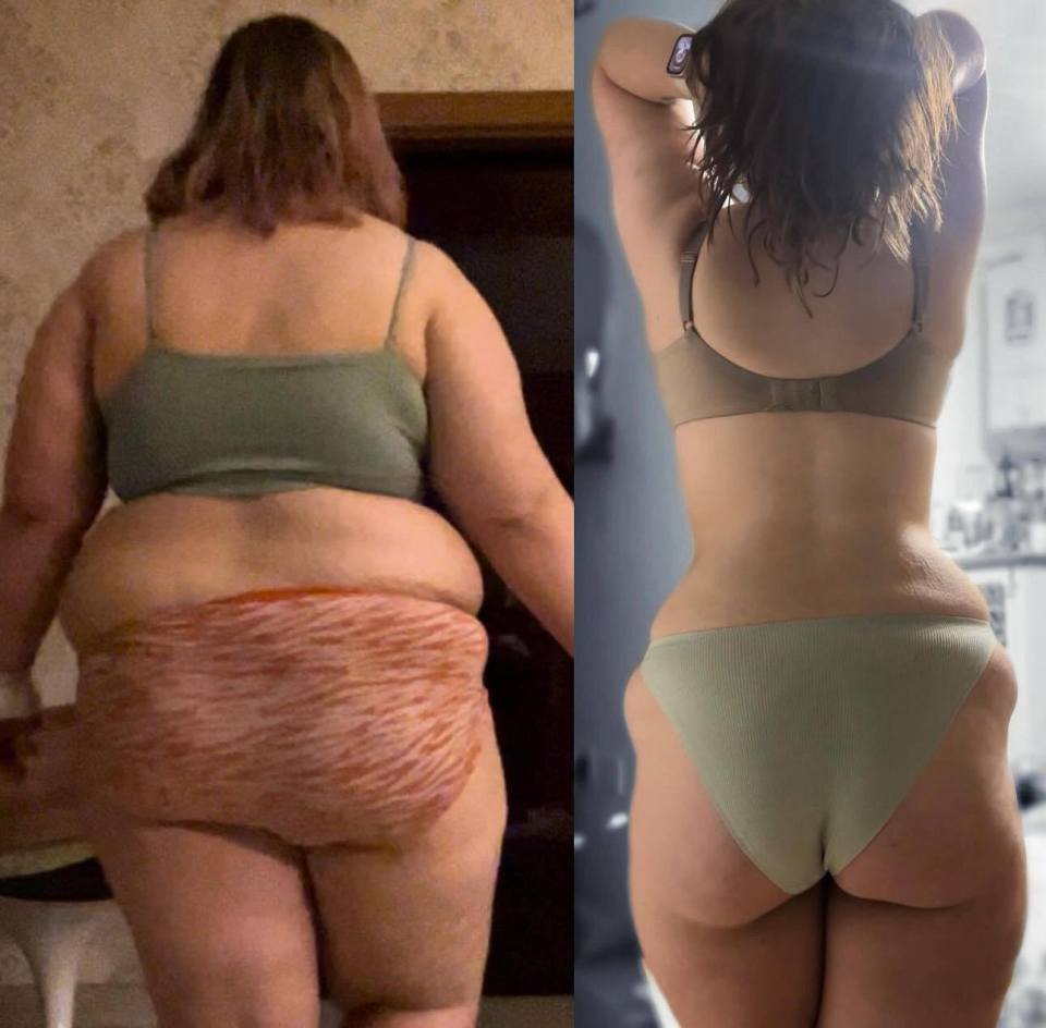 a before and after photo of a woman 's body