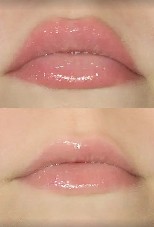 Shoppers have shared their before and after snaps from using the lip gloss