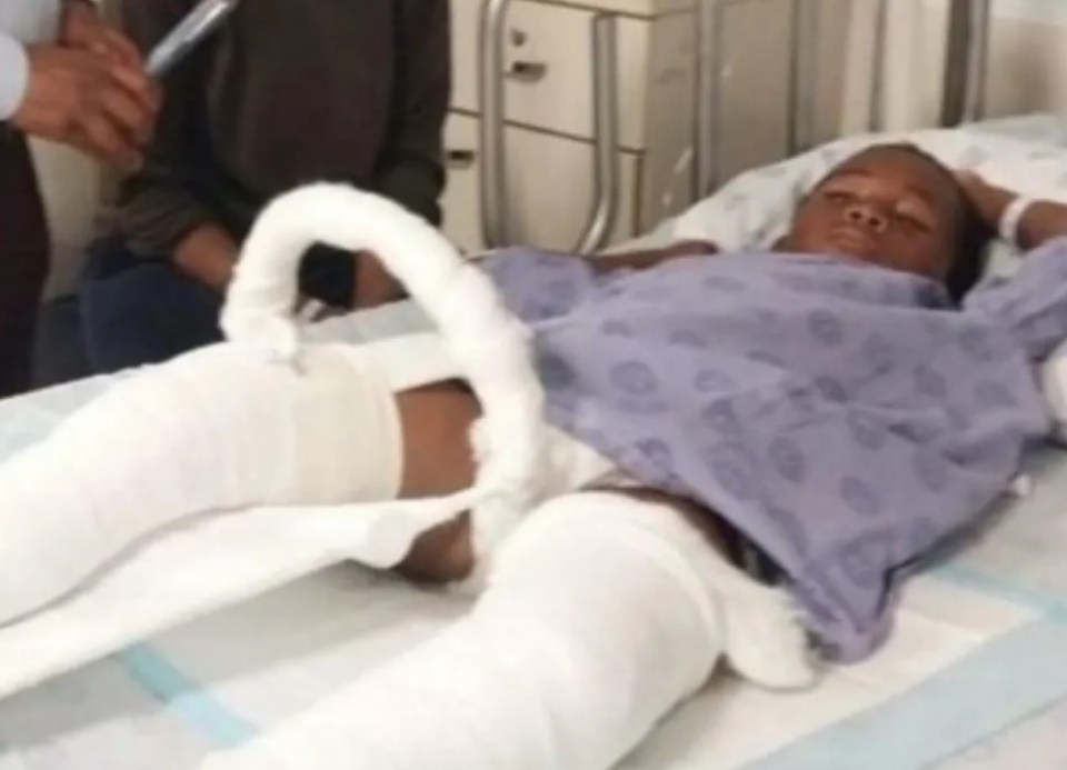 Khwezi, 6, broke both of his legs in the horrific incident