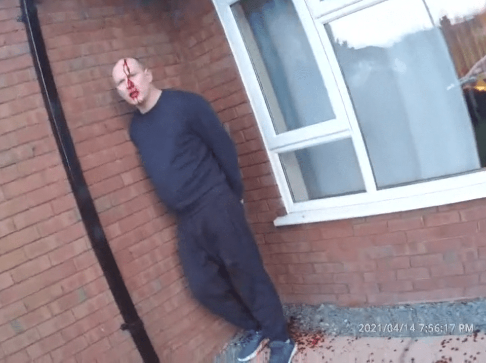 Blood-soaked Jamie Crosbie was arrested by police wielding tasers