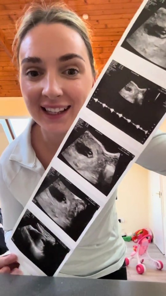 Chloe recently showed fans her first baby scan