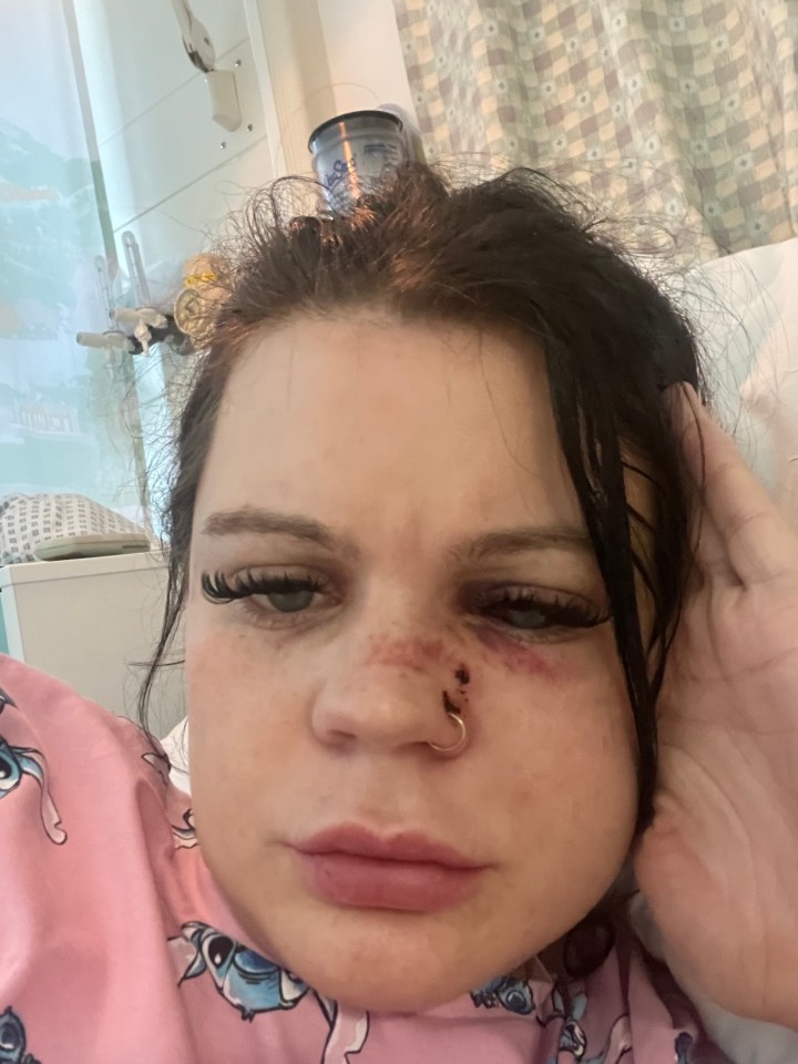 She was left battered and bruised by the assaults