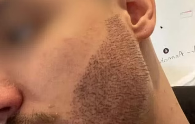 a close up of a man 's face with a beard and ear .